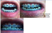 Coast Dental Orthodontic Treatment