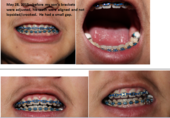 Coast Dental Orthodontic Treatment