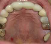 Tetracycline and dental problems